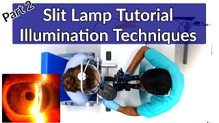 Slit Lamp Exam Tutorial  Part 2  Illumination Techniques [upl. by Kammerer412]