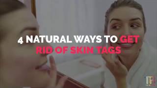 4 Right Ways To Get Rid Of Skin Tags On Eyelids Neck Armpits Approved By Dermatologists [upl. by Colyer]