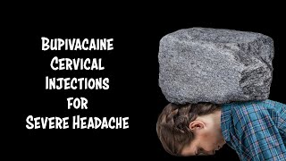 Cervical Injections for Headache in Honduras [upl. by Toscano915]