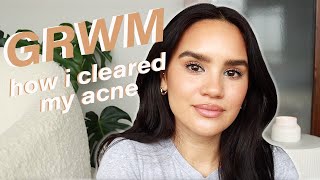 Get Ready With Me How I Cleared My Acne Skincare Haul  Update [upl. by Tann]