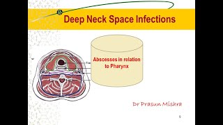 Deep Neck space Infections Part I  Anatomy and QUINSY [upl. by Lednic]