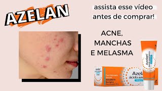 AZELAN E ÁCIDO AZELAICO PARA ACNE MANCHAS DE ACNE E MELASMA  como usar e qual a indicação [upl. by Annayad751]