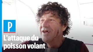 Vendée Globe  Jean Le Cam blessé au visage  percuté par un poisson volant [upl. by Ecinahc]