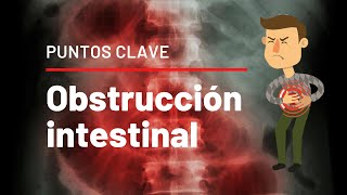 PUNTOS CLAVE de Obstrucción Intestinal [upl. by Imij]