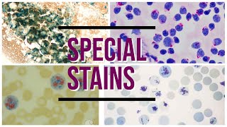 Special stains Hematology hematology pathology pathologylab stain [upl. by Aubyn694]