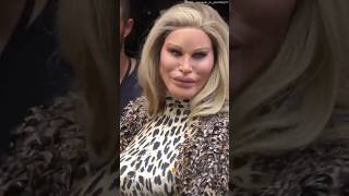 The Catwoman Transformation jocelynwildenston catwoman hollywood plasticsurgery surgery [upl. by Mihsah]