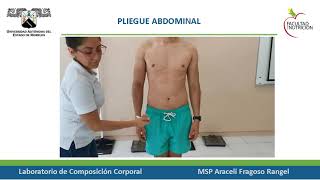 Pliegue Abdominal [upl. by Ahsikar]