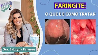 Faringite o que é e como tratar [upl. by Chirlin]