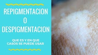 Despigmentacion o Repigmentacion  en que casos se puede usar  tratamiento para blanquear la piel [upl. by Tome398]