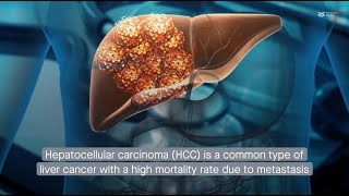 M2 macrophage–derived exosomes promote metastasis in hepatocellular carcinoma [upl. by Aribold949]