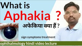 aphakia treatment  what is aphakia  aphakia and Pseudophakia  aphakia ophthalmologyhindi [upl. by Nevak]