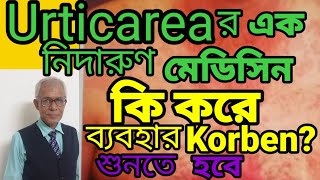 URTICARIA SKIN DISEASE IN BENGALI URTICARIA TREATMENT IN HOMEOPPATHY drmkroyhomeopath urticaria [upl. by Layney33]