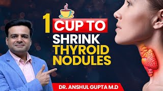 1 Cup Remedy to Shrink Thyroid Nodules [upl. by Pyszka879]