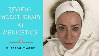 Review of Mesotherapy treatment at Medicetics clinic [upl. by Selie]