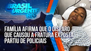 Criança sofre fratura exposta na perna ao ser acertada durante conflito entre policiais e criminosos [upl. by Consalve]