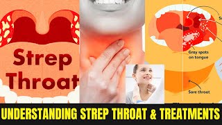 Understanding Strep Throat Contagiousness Transmission Prevention and Treatments 2024 [upl. by Minier]