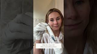 Microneedling at home Step by Step [upl. by Bandeen]