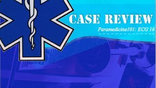 Paramedicine101 ECG Case 16 [upl. by Dremann47]