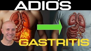 CURA tu GASTRITIS ¡Con estos pasos [upl. by Oilut597]