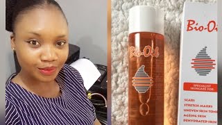 My Experience with Bio Oil Review and how to use for best results [upl. by Otrebor693]