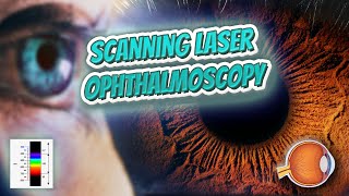 Scanning laser ophthalmoscopy Your EYEBALLS 👁️👁️💉😳💊🔊💯✅ [upl. by Gnouhp]