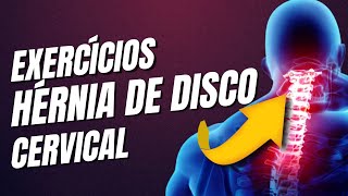 Ideias de EXERCÍCIOS para HÉRNIA DE DISCO CERVICAL [upl. by Atineg]