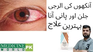 Tobradex Eye drops Tobramycin l Dexamethasone l Uses l Dose l Alternate brands [upl. by Akcimehs576]