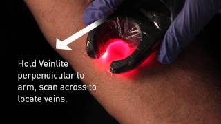 Veinlite LED Vein Finder Demo [upl. by Litsyrk]