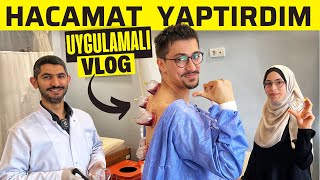 EVDE HACAMAT YAPILIR MI 🩸 KİMLERE YASAK 😳 Hacamatın Faydaları Nelerdir  Hacamat Nasıl Yapılır [upl. by Lev]