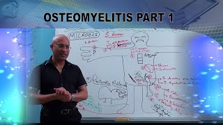 Osteomyelitis  Causes amp Symptoms  Bone Infection🩺 [upl. by Airitac]