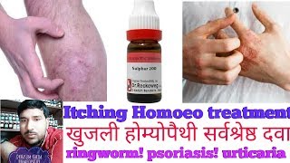 Itching skin disease Homoeopathy best medicines खुजली होम्योपैथी सर्वश्रेष्ठ दवा [upl. by Barta993]