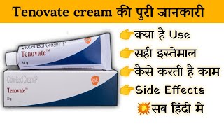 tenovate cream uses  price  composition  dose  side effects  review  in hindi [upl. by Schecter]