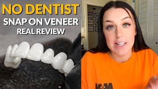 Snap On Removable Dental Veneers Review  The Best Alternative to 20000 Cosmetic Dentistry [upl. by Eissed]