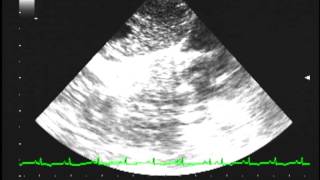 Heartworm disease echocardiography [upl. by Waine]