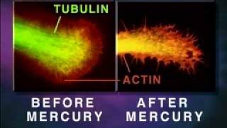 NeuroToxin  Mercury Melts Your Brain [upl. by Neliac]