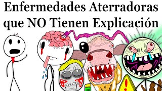 Enfermedades Más Aterradoras que la Ciencia NO Puede Explicar [upl. by Roye]