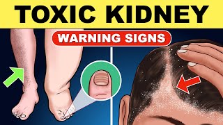 10 Warning Signs That Your Kidneys are Toxic  Chronic Kidney Disease  Kidney Health  CKD [upl. by Ulphiah683]