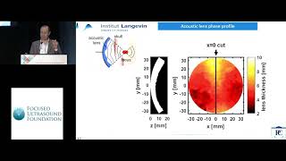 JeanFrancois Aubry  Lowcost transcranial FUS 2018 [upl. by Pandora745]