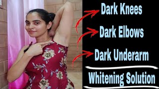 Dark UnderarmDark ElbowsDark Knees Whitening Solution nimmaashwini underarmwhitening [upl. by Richman40]