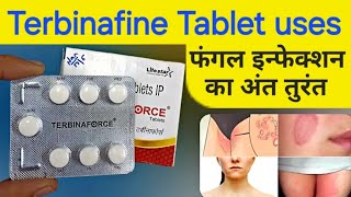 Terbinafine tablets ip 250 mg  terbinafine tablets uses in hindi  terbinaforce tablets [upl. by Ratna]