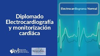 Electrocardiograma normal [upl. by Odlareg206]