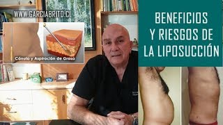 EL DR ENSEÑA  BENEFICIOS Y RIESGOS DE LA LIPOSUCCIÓN [upl. by Gertie15]