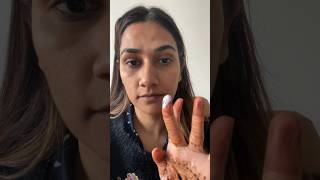 How to remove dry lips at home shorts youtubeshorts viral lipcare wintercare lips drylips [upl. by Mareld]