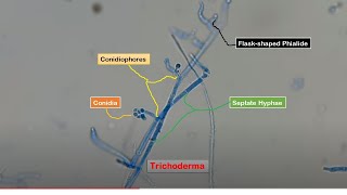 Conidia Phialides and Conidiophores of Trichoderma in LPCB Preparation [upl. by Lleon]