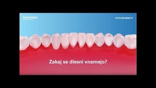 Zakaj se dlesni vnamejo [upl. by Kavita]