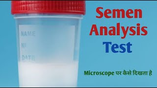 Semen test procedure I sperm count [upl. by Raines]