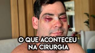 Fiz Uma Cirurgia Nos Olhos  Como Ficou [upl. by Ingold210]