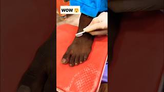 Permanent Feet Dirt amp Tanning Removal PackMost Easy Pedicure diy ytshorts shorts [upl. by Natassia236]