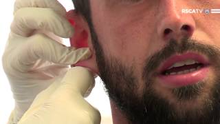 RSCAtv  medical tests Steven Defour [upl. by Araihc]