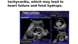 First Trimester Pathology for sonographers [upl. by Avuha]